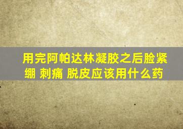 用完阿帕达林凝胶之后脸紧绷 刺痛 脱皮应该用什么药
